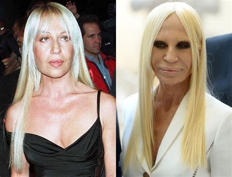 donatella versace young 80s|donatella versace before and after surgery.